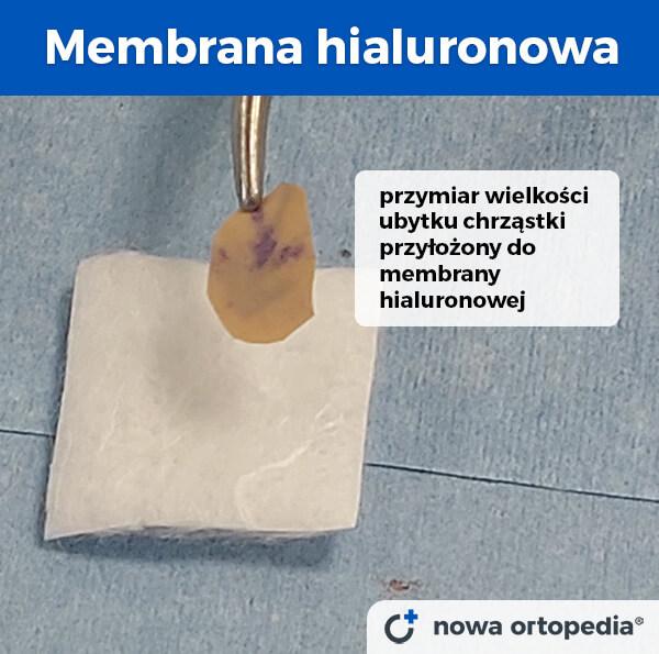 membrana hyalofast comp